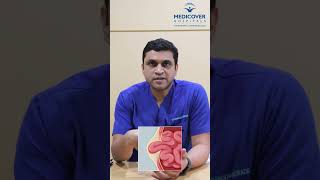 Know About Hernia  Medicover Hospitals  Chhatrapati Sambhajinagar [upl. by Grannias651]