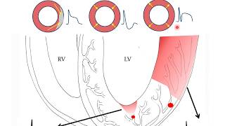 ELearning 1B ECG beoordelen [upl. by Razal]