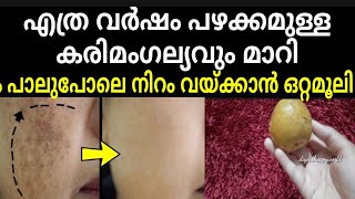 കരിമംഗല്യം മാറാൻ ഇതിനേക്കാൾ നല്ല വഴി ഇനി സ്വപ്നങ്ങളിൽ മാത്രംbest treatment for pigmentation on face [upl. by Babb]