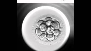 Embryoscope 2  Nuevo método de cultivo y selección embrionaria [upl. by Octavla]