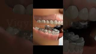 Jaw Treatment teeth dentist health [upl. by Cheston944]