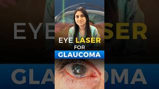 Eye Laser for Glaucoma [upl. by Miculek]