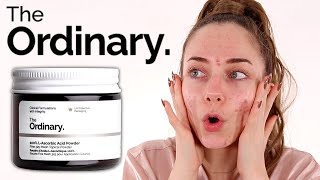 The Ordinary 100 LAscorbic Acid Powder Review  Vitamin C Powder [upl. by Nyleahcim]