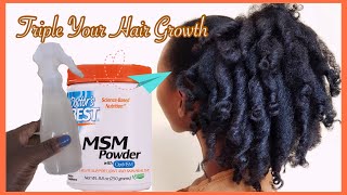 This Will Triple Your Hair Growth MSM New changes On My Hair Treatments [upl. by Nylyaj]