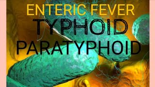 Enteric Fever  Typhoid fever  Paratyphoid Fever  Medicine  Microbiology [upl. by Newbold]