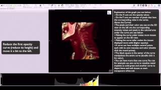 Osirix 16bit clut editor in 3D view [upl. by Herr429]