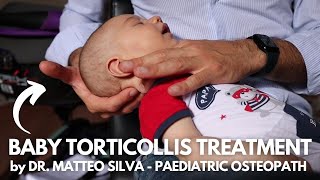 TORTICOLLIS TREATMENT by DR MATTEO SILVA  Paediatric Osteopath [upl. by Adieno44]