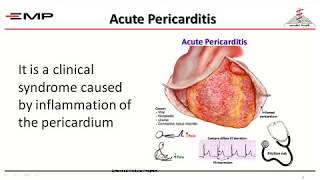 pericardial diseases By DrAdel Shabana [upl. by Bills]