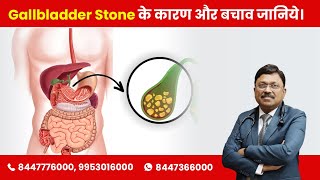 Gallstones Causes and Prevention  Gallbladder Stone के कारण और बचाव जानिये Dr Bimal Chhajer SAAOL [upl. by Orvas]