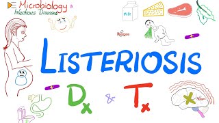 Listeria monocytogenes Listeriosis  Diagnosis and Treatment  Microbiology 🧫 [upl. by Hserus]