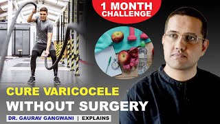 Varicocele natural treatment  Varicocele treatment without any surgery  Dr Gaurav Gangwani [upl. by Ennovahc636]