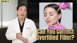 How to Fix Overfilled Migrated Filler Face  Wave Plastic Surgery [upl. by Eniahpets604]