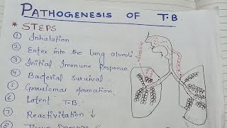 pathogenesis of tuberculosis NGMedicals [upl. by Aitnic900]