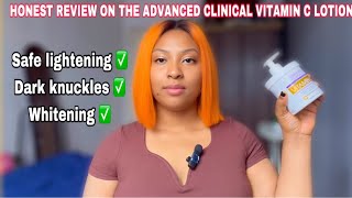 HONEST REVIEW ON THE ADVANCED CLINICALS VITAMIN C LOTION  WHITENING AND LIGHTENING SKIN [upl. by Hgielrebma116]