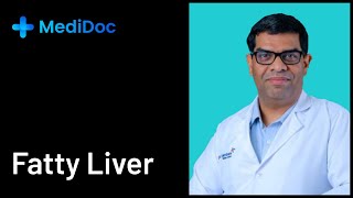 കരൾക്കൊഴുപ്പ്  Fatty Liver  Myths and Facts  MediDoc  Episode 12 [upl. by Aldus]