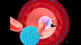 Dyslipidemia [upl. by Assir]