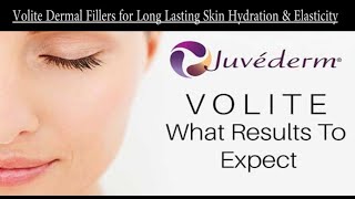 Juvederm Volite Fillers for long lasting skin hydration and rejuvenation contact 9700020802 [upl. by Nahtam]