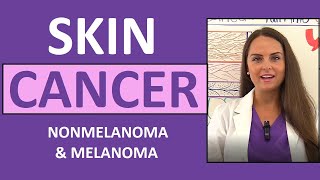 Skin Cancer Basal Squamous Cell Carcinoma Melanoma Actinic Keratosis Nursing NCLEX [upl. by Tychonn]