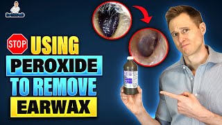 Stop Using Hydrogen Peroxide to remove Earwax [upl. by Lamarre]