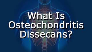 What Is Osteochondritis Dissecans [upl. by Etnuahs]