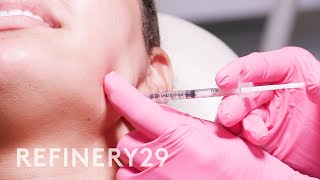 I Tried Jawline Contour amp Masseter Botox  Macro Beauty  Refinery29 [upl. by Aicnorev]