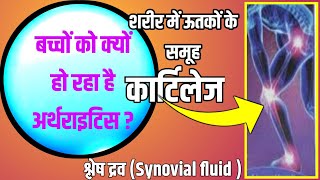 Gout Vati R100 gold गठिया जॉइंट पैन कमर दर्द पीठ दर्द का इलाज  बच्चों को हो रहा है अर्थराइटिस [upl. by Heshum]