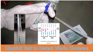 Vibrio cholerae Rapid Diagnostic Test Procedure for Serotypes O1 and O139 [upl. by Kernan187]