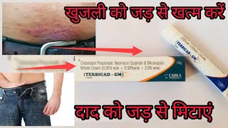 बड़े से बड़े दाद और खुजली को करे खत्म ।। Terbicad GM cream full review in hindi 2023 [upl. by Edlitam]