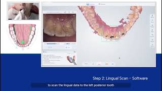 Lower Jaw Scanning Operation Guidelines with Yucera YRCS02 Dental Scanner [upl. by Aurelius]