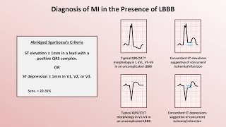 Intro to EKG Interpretation  Myocardial Infarctions Part 2 of 2 [upl. by Hauhsoj]