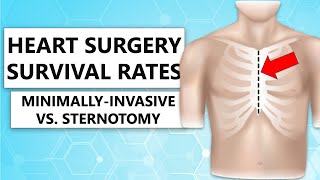 Surgeon QampA “Survival Rates of MinimallyInvasive Versus Sternotomy for Heart Valve Surgery” [upl. by Aara]