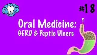 Oral Medicine  GERD amp Peptic Ulcers  INBDE [upl. by Anola]