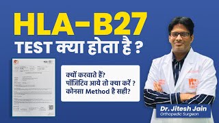 HLAB27 test क्या होता है Back Pain Test  Positive आये तो क्या करें  Dr Jitesh Jain [upl. by Able992]