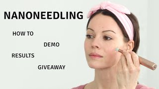 Nano Needling  Everything You Need to Know  Giveaway [upl. by Nennek]