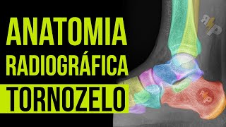 Anatomia Radiográfica  Tornozelo PERFIL [upl. by Orran810]