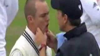 Cricketer loses tooth from Jimmy Anderson bouncer [upl. by Tanney]