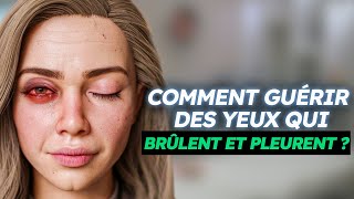 Comment guérir naturellement de Vos Yeux Secs [upl. by Adnir]