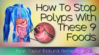 Foods That Prevent Polyps in the Colon [upl. by Jaycee492]