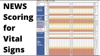 How to Fill in a NEWS Chart  OSCE Revision [upl. by Stefan43]