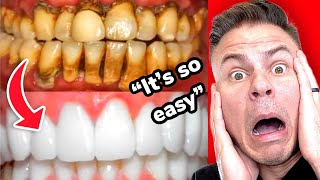 Dentist EXPOSES TikTok Teeth Whitening Trends [upl. by Llenral]