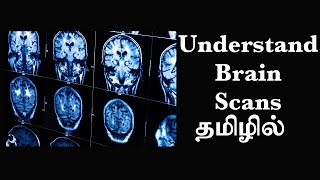 தொழில்நுட்ப்பத்தின் மூலம் மூளையைப்புரிந்துகொள்ளும் முறை Ep8 Basic Psychology in Tamil [upl. by Camus]