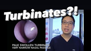 Inferior Turbinates what are they why do they swell stuffy nose congestion how do we treat [upl. by Beaufort]