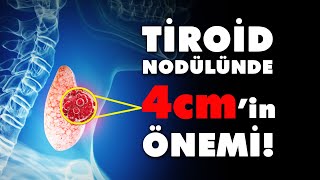 Tiroid Nodülünde 4cm’in Önemi [upl. by Anelrahc]