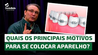 Quais os principais motivos para se colocar aparelho dentário  DenteBelo [upl. by Athalee607]