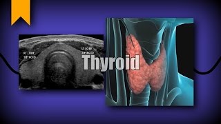 Thyroid Ultrasound [upl. by Nnaasil693]