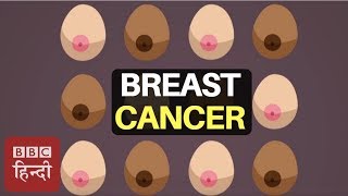 How To Recognise 12 Symptoms of Breast Cancer  BBC Duniya [upl. by Meadow]