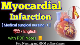 Myocardial infarction  Myocardial infarction in hindi  Myocardial infarction msn  bsc nursing 2nd [upl. by Outlaw786]