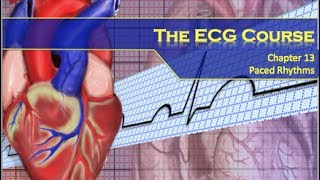 The ECG Course  Paced Rhythms [upl. by Mayfield860]