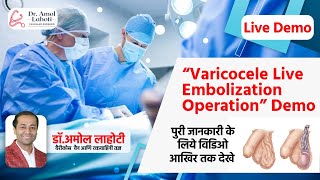 Understanding Varicocele Treatment  Angiography amp Wire Placement in Embolization  Dr Amol Lahoti [upl. by Niboc666]