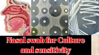 Nasal Swab for culture and sensitivity CS test [upl. by Nayrb244]